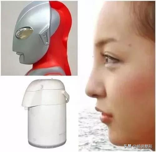 六种常见的失败隆鼻手术,隆鼻怎么预防鼻头越来越尖