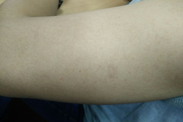 搓澡黑色皮子有用吗,洗澡搓出来的东西有必要吗