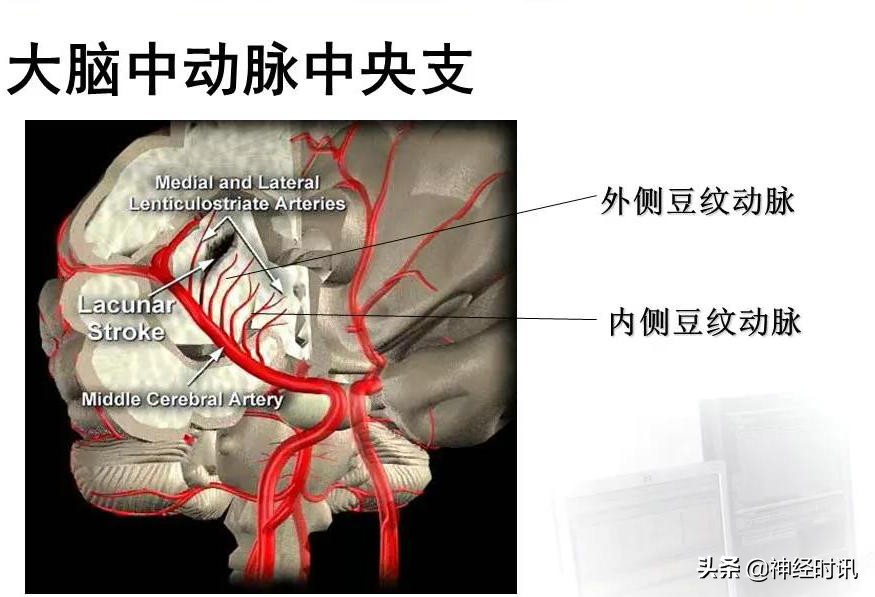 脑动脉解剖学讲解,脑膜中动脉解剖讲解