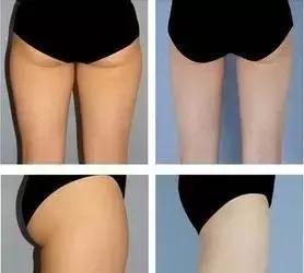 臀部两侧陷窝,臀部臀窝怎么练