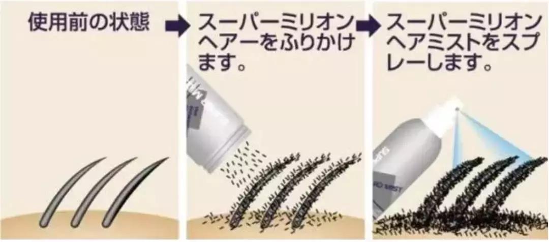 岛国这款生发神器，让你一言不合就长成热带雨林