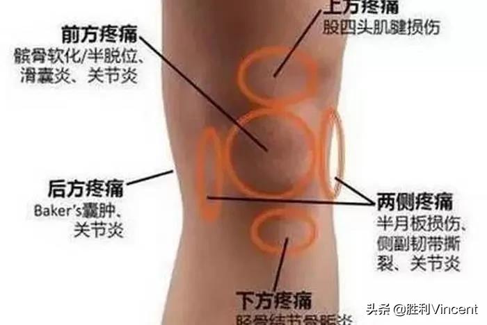 爬山下山后膝关节疼痛怎样缓解,登山跑步膝盖疼怎么办