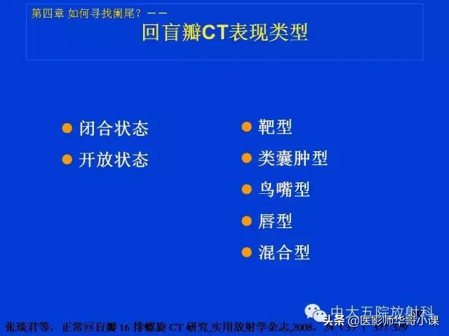 阑尾炎课件,阑尾炎的超声课件