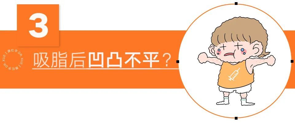 吸脂须知,吸脂必知