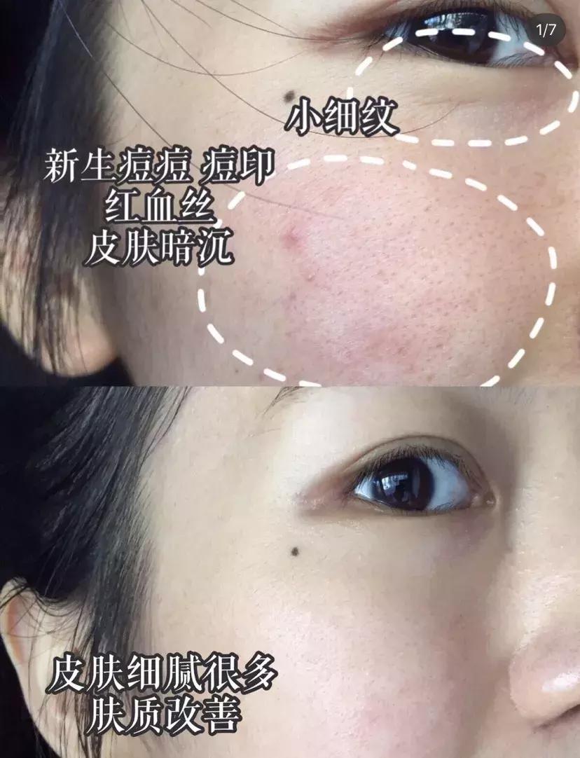 日本女生身体美白的秘诀,日本女人美白的秘密