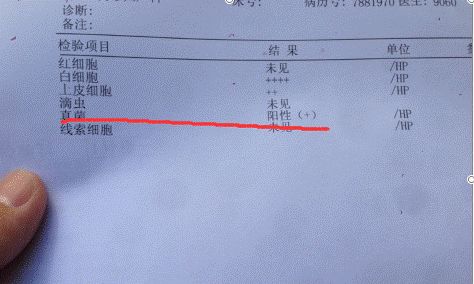 霉菌性阴道炎的引起原因,霉菌性阴道炎的原因