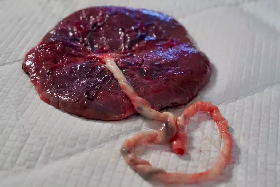 “花式”吃胎盘，不一定大补，还可能“有毒”