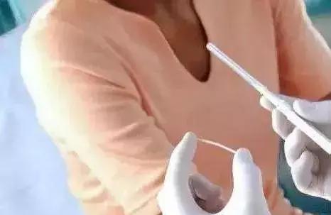 小小一根棒，比套套和上环安全，避孕率超高却少有人知道