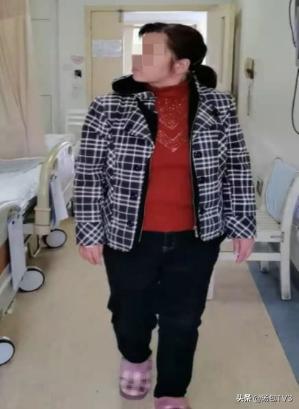 美容神器肉毒毒素“扶正”歪了一年的脖子病因竟是痉挛性斜颈