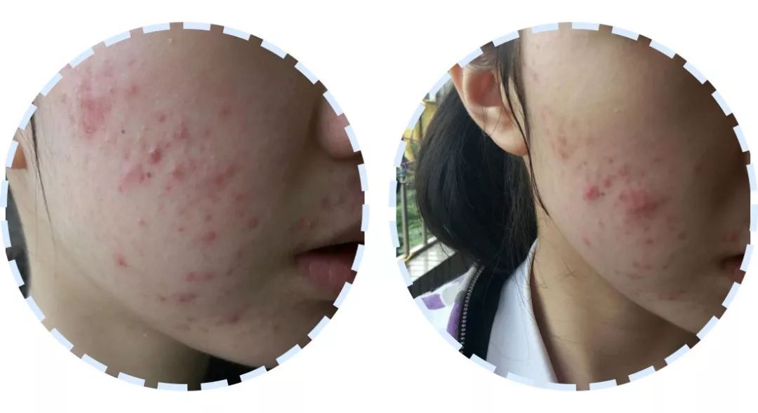 被拔草的护肤品,拔草70多种护肤品