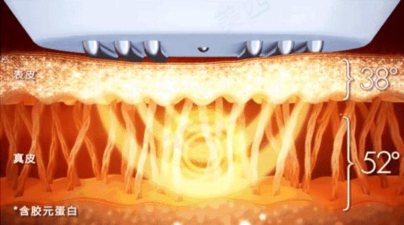 小茂肌诊室∣美容仪挑战：家用美容仪到底值得投资吗？