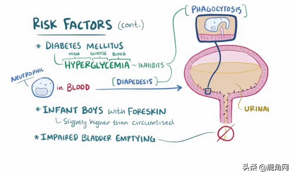 为什么会总是感觉尿急,为什么会尿急