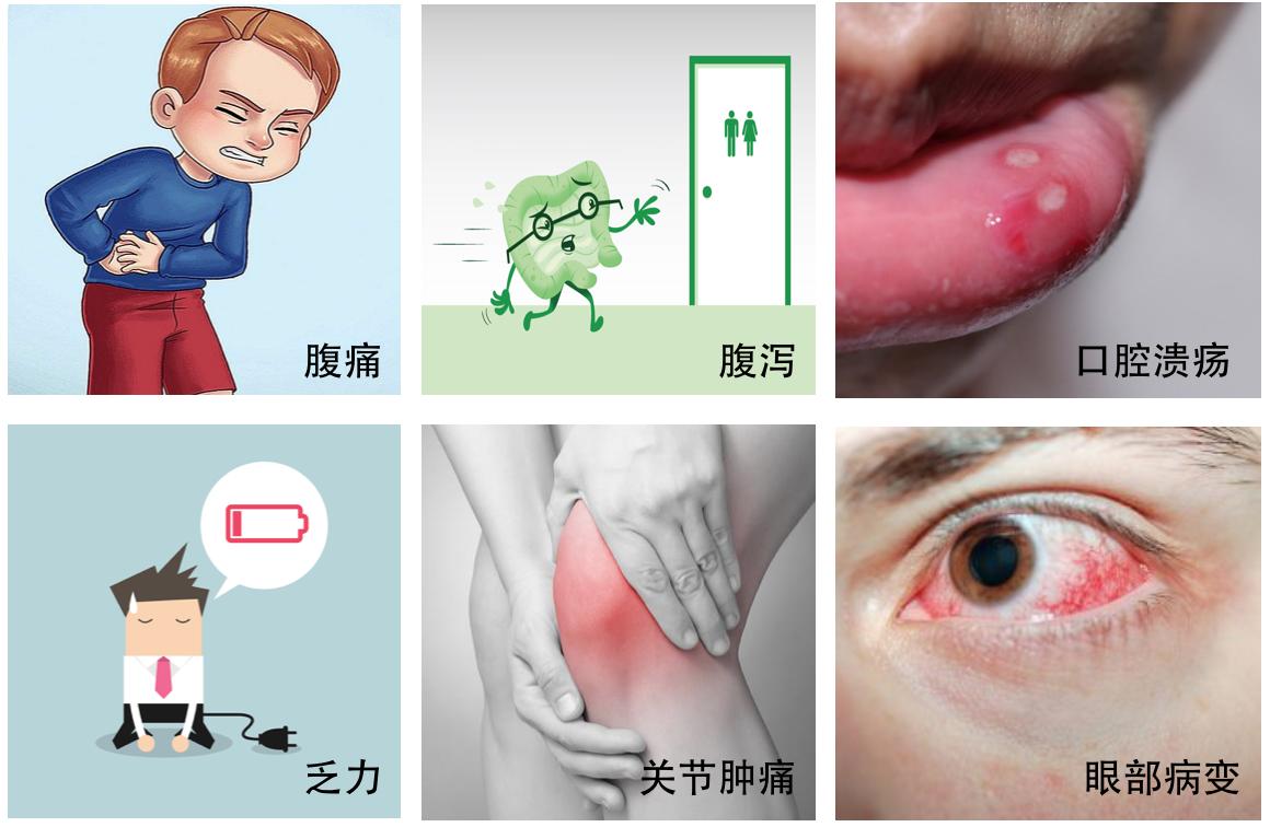 溃疡性结肠炎吃哪种益生菌好,溃疡性结肠炎吃什么益生菌有效