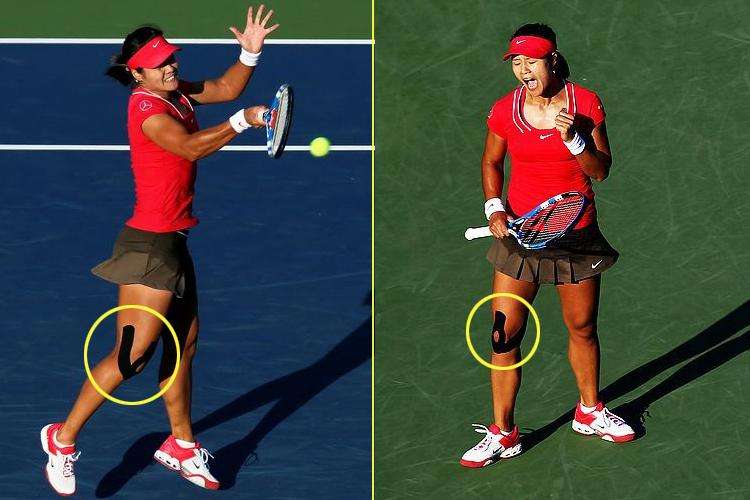 鹅足炎的理疗方法,鹅足炎不治能好吗