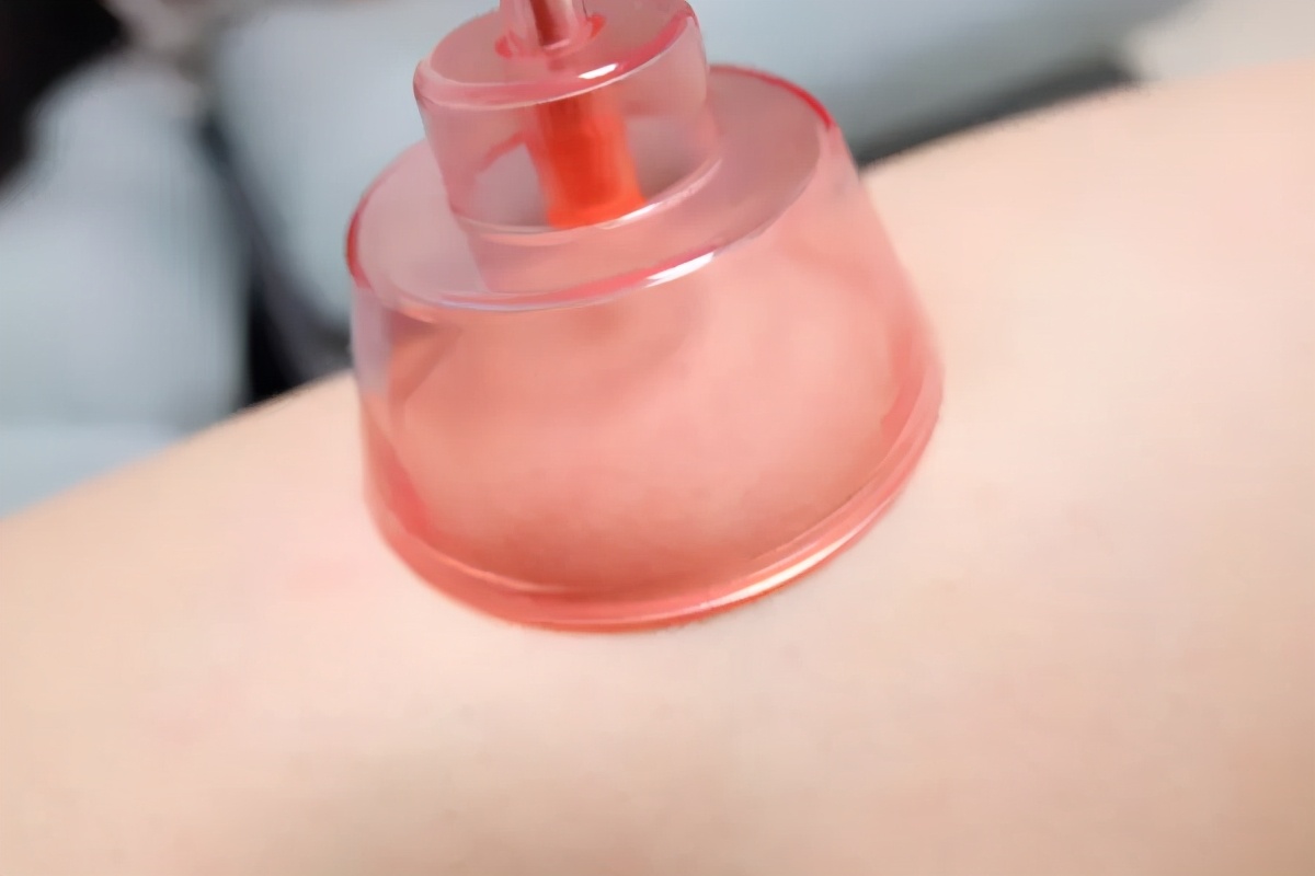 左点砭石刮痧按摩器怎么样,左点智能砭石刮痧按摩器怎么样