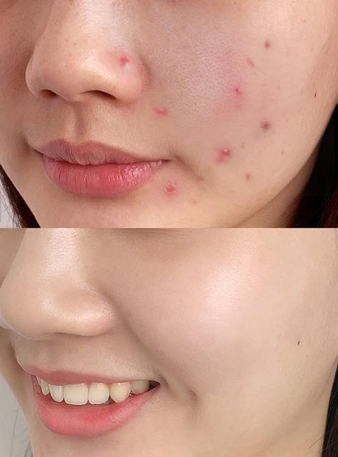 国货好用平价护肤品标婷,国货的护肤品排行榜片仔癀