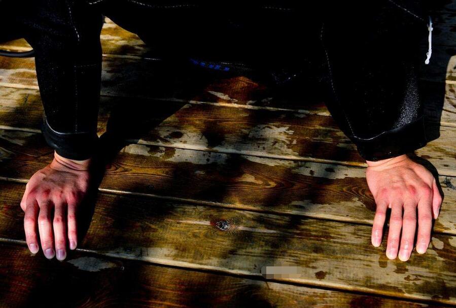 如何防止手冻的小妙招,冬天冻手怎么提前用药预防