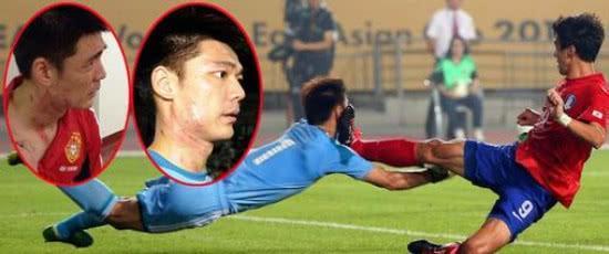 曾诚现在的状态,曾诚比赛中重伤