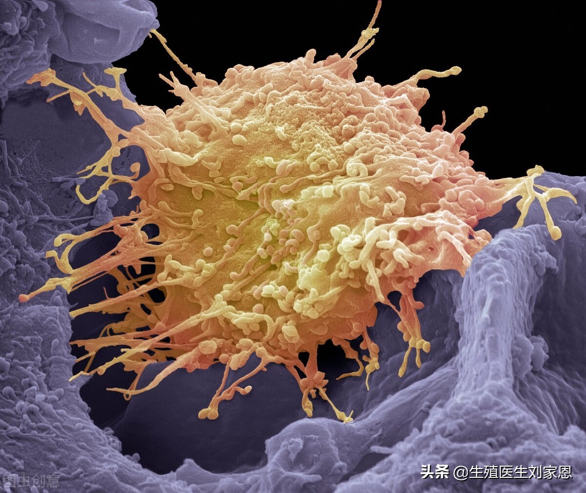 感染了hpv还能结婚吗,感染了hpv还能怀孕吗