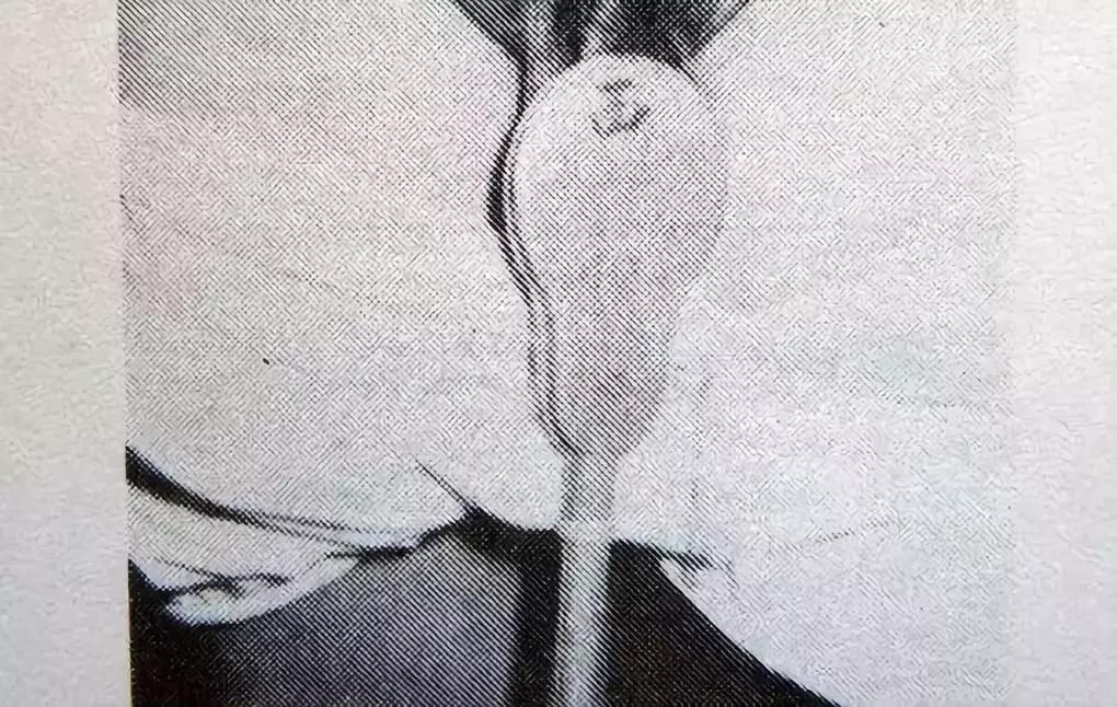 精神病会通过网络传染吗,精神病有没有潜在传染可能性