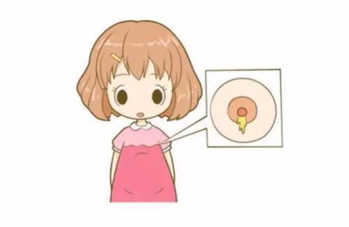 孕妈妈们哺乳期乳头皲裂受伤不用怕，护理预防有妙招