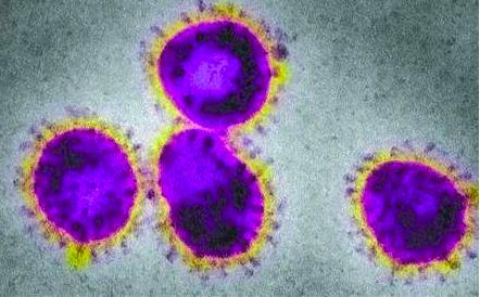 欧洲瘟疫死亡2500万人是哪一年,人类最大的瘟疫