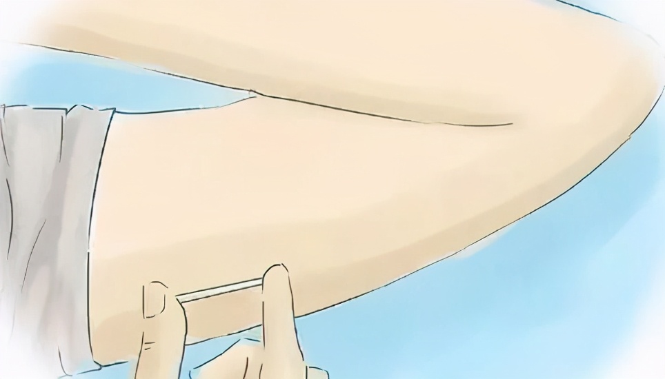 剖了两胎又怀孕了,剖宫产4个月后发现怀孕了