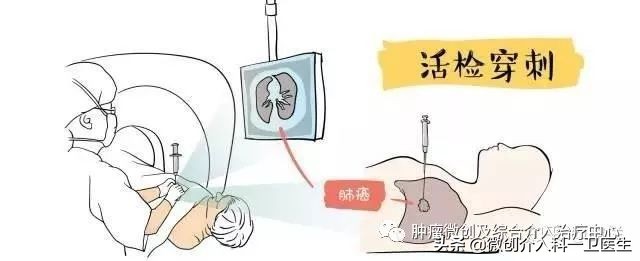 运城市第一医院肿瘤手术,运城市第一医院微创介入手术