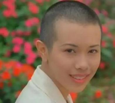 植发必须要理光头吗？