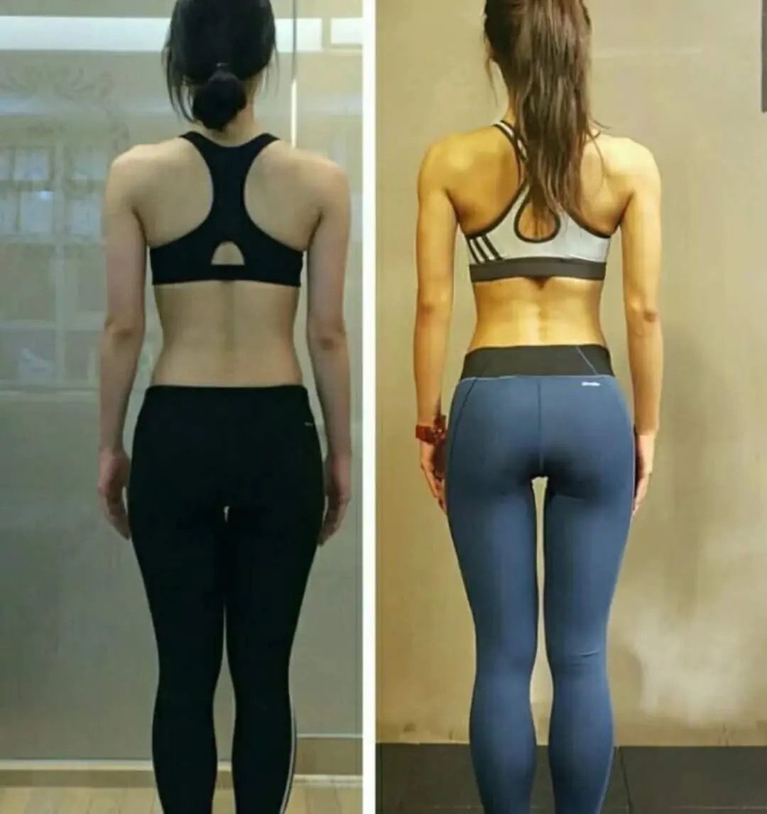 激素型减肥的最佳方法,激素性肥胖停用激素能瘦吗