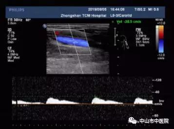 肩臂痛怎么治疗,肩臂痛什么原因