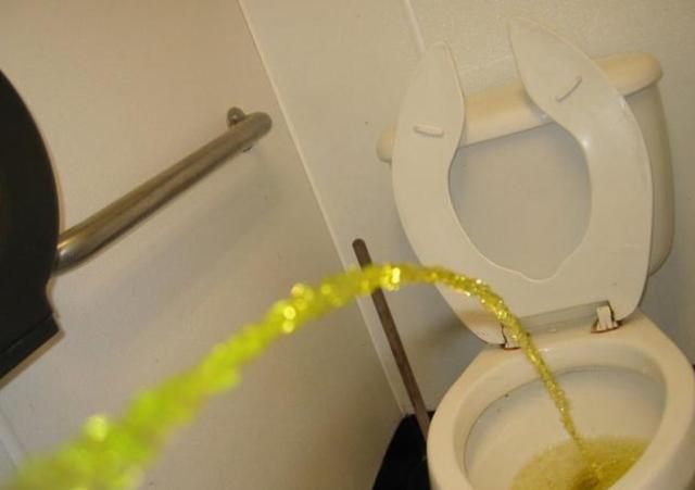 上厕所时尿液发臭什么原因,上厕所尿液比较浑浊是什么原因