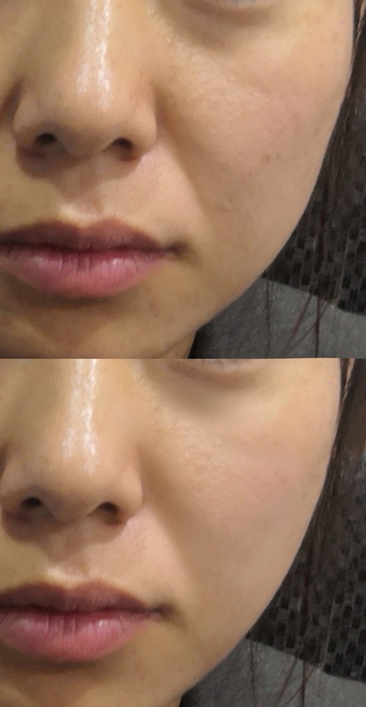 一次拨筋等于10次美容,一次面部拨筋胜过10次美容护肤