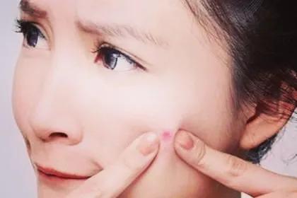 快来月经了下巴长痘痘是什么原因,经期下巴长痘痘是什么原因引起的