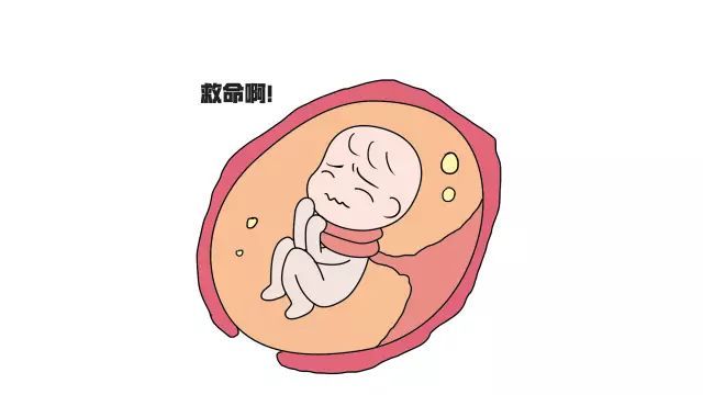 脐带绕颈怎么办如何快速解决,脐带绕颈有危险吗有什么建议