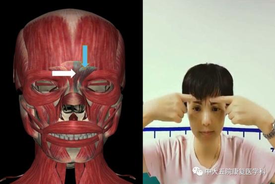 面瘫临床表现的科普视频,科普面瘫多久治疗效果最好