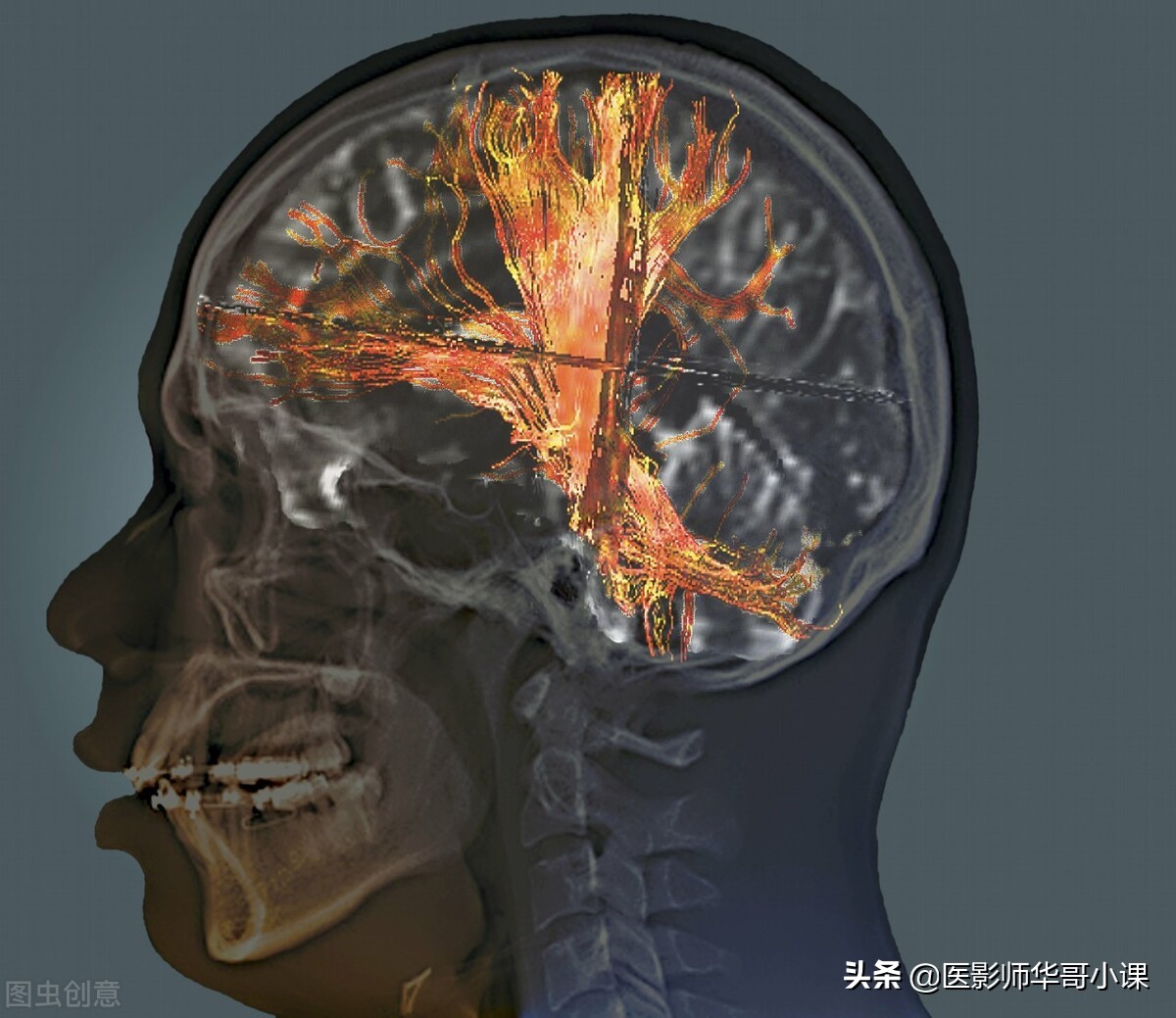 飞利浦磁共振波谱成像扫描技术,飞利浦磁共振纵隔扫描技术
