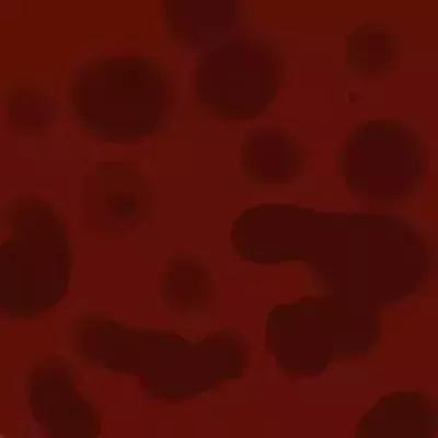 恶露少说明子宫恢复不好吗,产后子宫恶露没排净怎么办