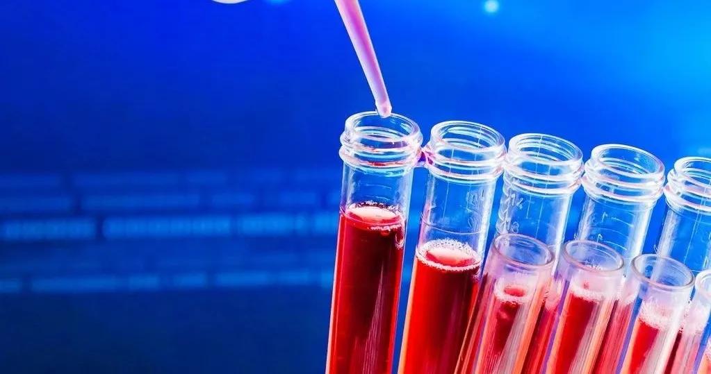 胆碱酯酶检查是13.86高吗,胆碱酯酶是检查哪个功能的