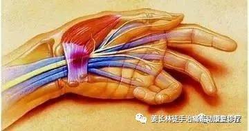 尺神经卡压自我恢复锻炼,枕大神经卡压自我恢复锻炼