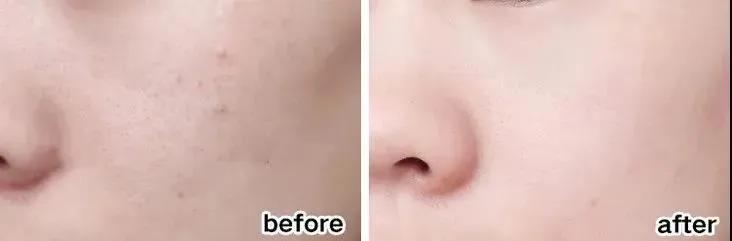 “38岁的年纪,18岁的脸”:能保持年轻的女人,手里少不了它