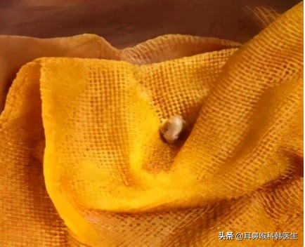 为啥来院就做内镜检查?医生怕是在骗我钱吧