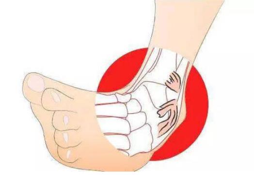 足背部疼痛常见原因是什么引起的,足跟痛的5种常见疾病解析