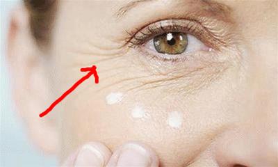 为什么用眼霜反而细纹多了,眼霜用了到底有没有效果