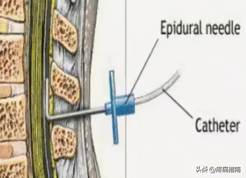 疼痛的康复瑜伽,疼痛的康复