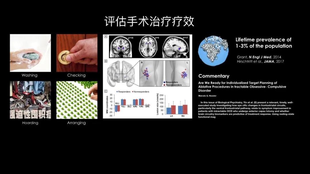 五个能控制你大脑的可怕实验,电击治疗精神分裂症会失忆吗