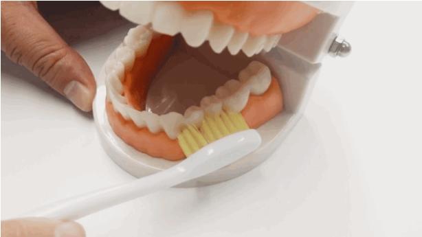 孕期口腔病变,孕期口腔病有哪些