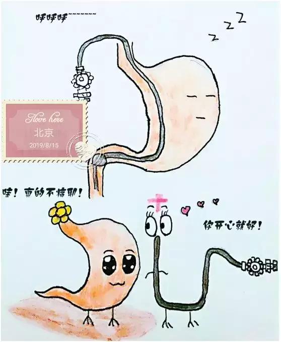 食管壁上美丽的“莲花”在无痛胃肠镜下现出了魔影