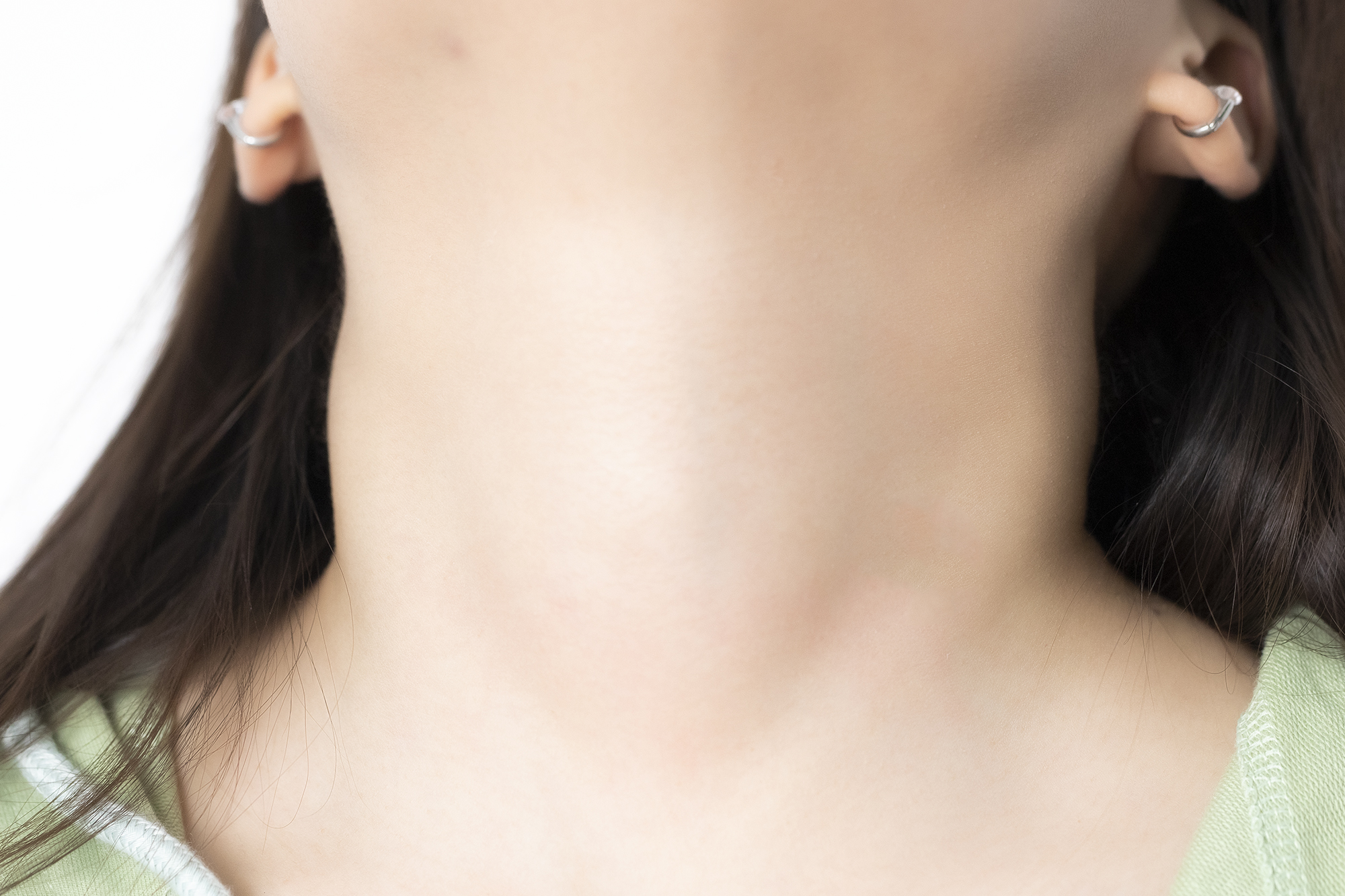 解决黑头的2种药,解决黑头的最好方法