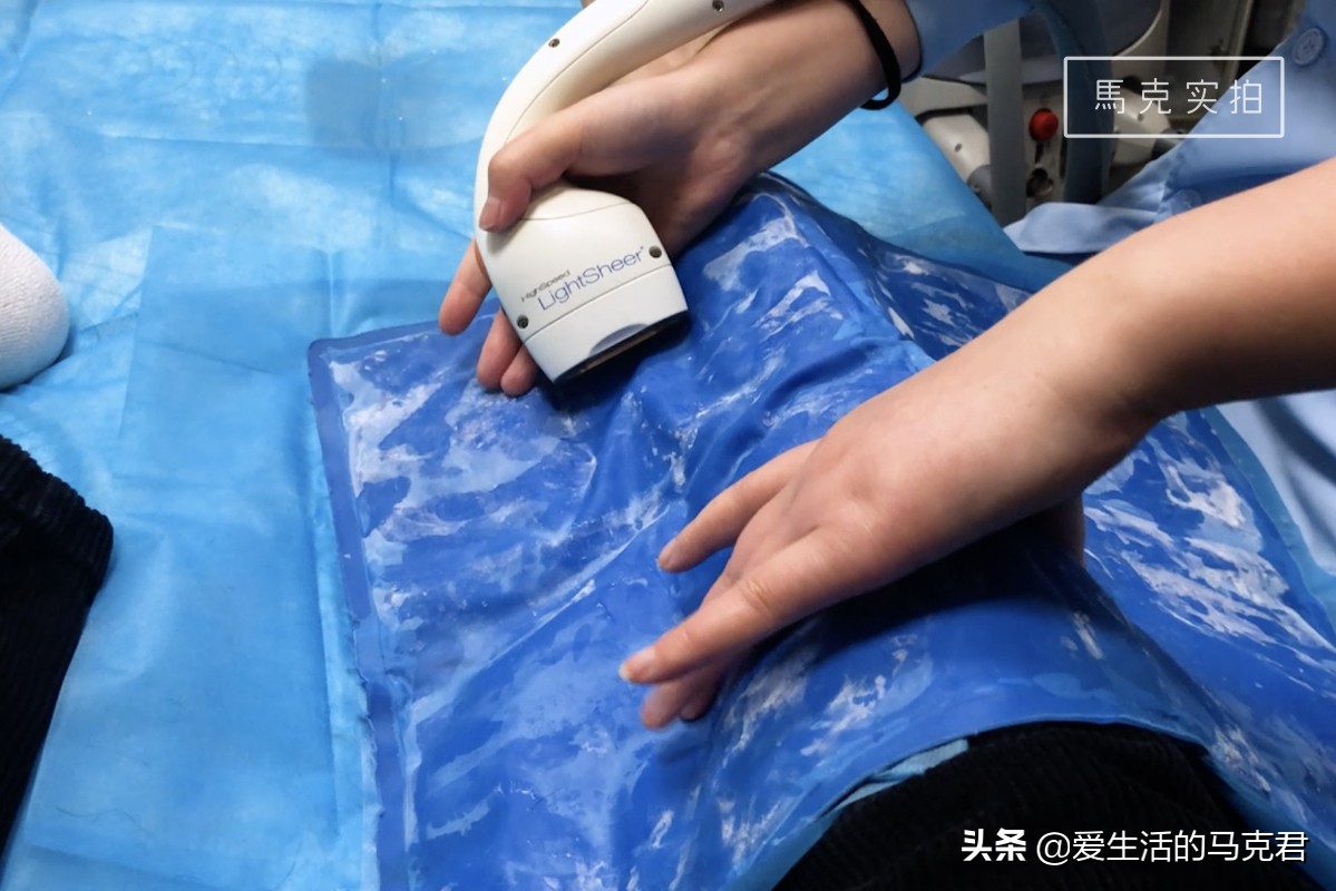 家用脱毛仪哪个牌子脱毛效果最好,家用激光脱毛仪是智商税吗